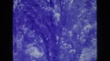 New Jersey USA (1966): Snow Blankets A Hillside And The Trees Covering Its Slope