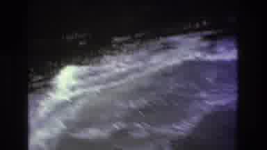 Boston USA (1975): A Person Jet-Skiing And Causing Small Waves To Emanate Around
