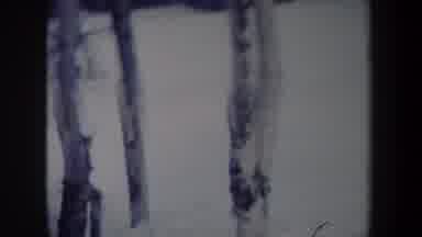 New York USA (1962): People Are Skiing It Is Winter And They Near A Forest