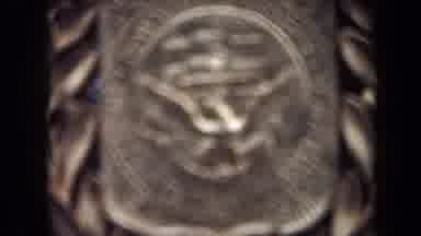 Washington DC USA (1970): Golden Medallions In A Wreath-Like Setting Are Shown And