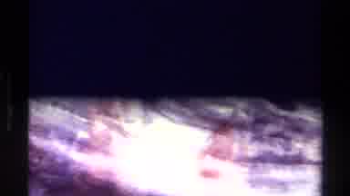 Canada (1979): Indistinct Picture Showing Either A Rock Cliff Face Or A Close Up