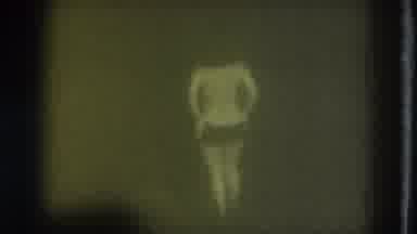 San Francisco California (1975): A Front View Of The Body Of A Naked Woman And She