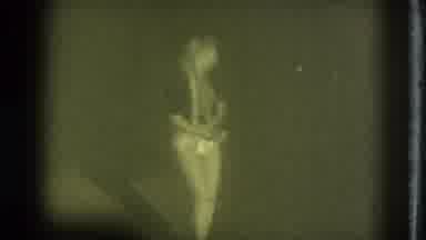 San Francisco California (1975): Woman Dancing And Stripping On The Stage In
