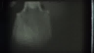 San Francisco California (1975): A Lady Dances On Stage In The Spotlight Wearing A