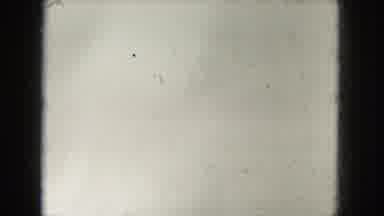 Milwaukee Wisconsin (1953): Adolescent Girl In Front Yard Grabbing Her Shoe