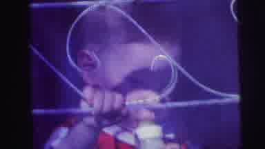 Lynbrook New York (1973): Closeup Of Young Boy Holding On To Metal Railing With