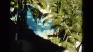 Acapulco Mexico (1962): So Many Coconut Trees Are Surrounded Near The Swimming