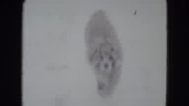 Madison Wisconsin USA (1960): A Dog Enjoys Investigating And Running In A Fresh