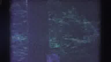 Hagerstown Maryland USA (1961): Driving Past Forest Of Trees And People In An