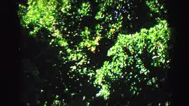 Vancouver Bc Canada (1968): Footage Of A Tree And Grass In A Backyard During The