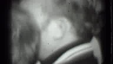 Moscow Russia (1975): Black And White Visual Of Face Hair And Ears Of A Head