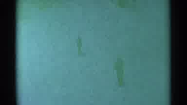 South Dakota (1959): People On A Snow Slope One Sliding Down The Hill Mountain