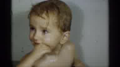 Michigan USA (1939): A Young Child Who Is Very Upset During And After Taking A