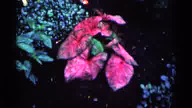 Minnesota USA (1964): Pink Blooming Flowers On A Bright Sunny Day