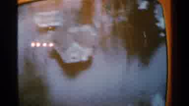 Minnesota USA (1965): Calamities And Flood â The Aftermath
