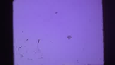 LYNBROOK NEW YORK-broo: Blurry And Broken Clip