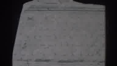 EPHESUS TURKEY-1962: Tourist Compares His Foot To An Iconic Work Of Art
