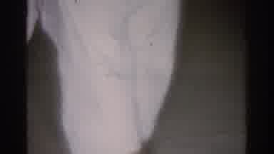 West Covina California (1966): Martial Arts Fight Movement Between Two Males One