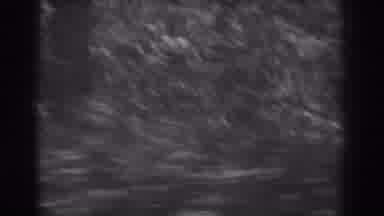 West Virginia (1938): Black And White Panning Longs Woods With Small Trees Bushes