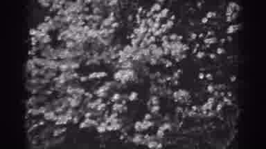 Winchester Maryland (1938): Old Video Tape Of Trees