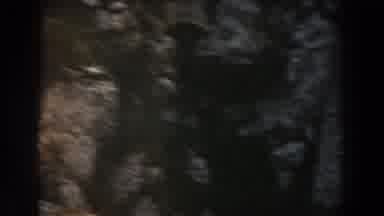 Italy (1960): A Rocky Cliff Has Brush And Small Trees Dotting Its Face Followed By