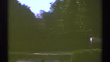 Los Angeles California (1969): Trees And Hedges In A Park Of An Urbanization With