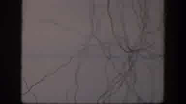 Utah (1951): Moving Zoom On Dendrites Strings Under A Microscope Maybe Hair Or