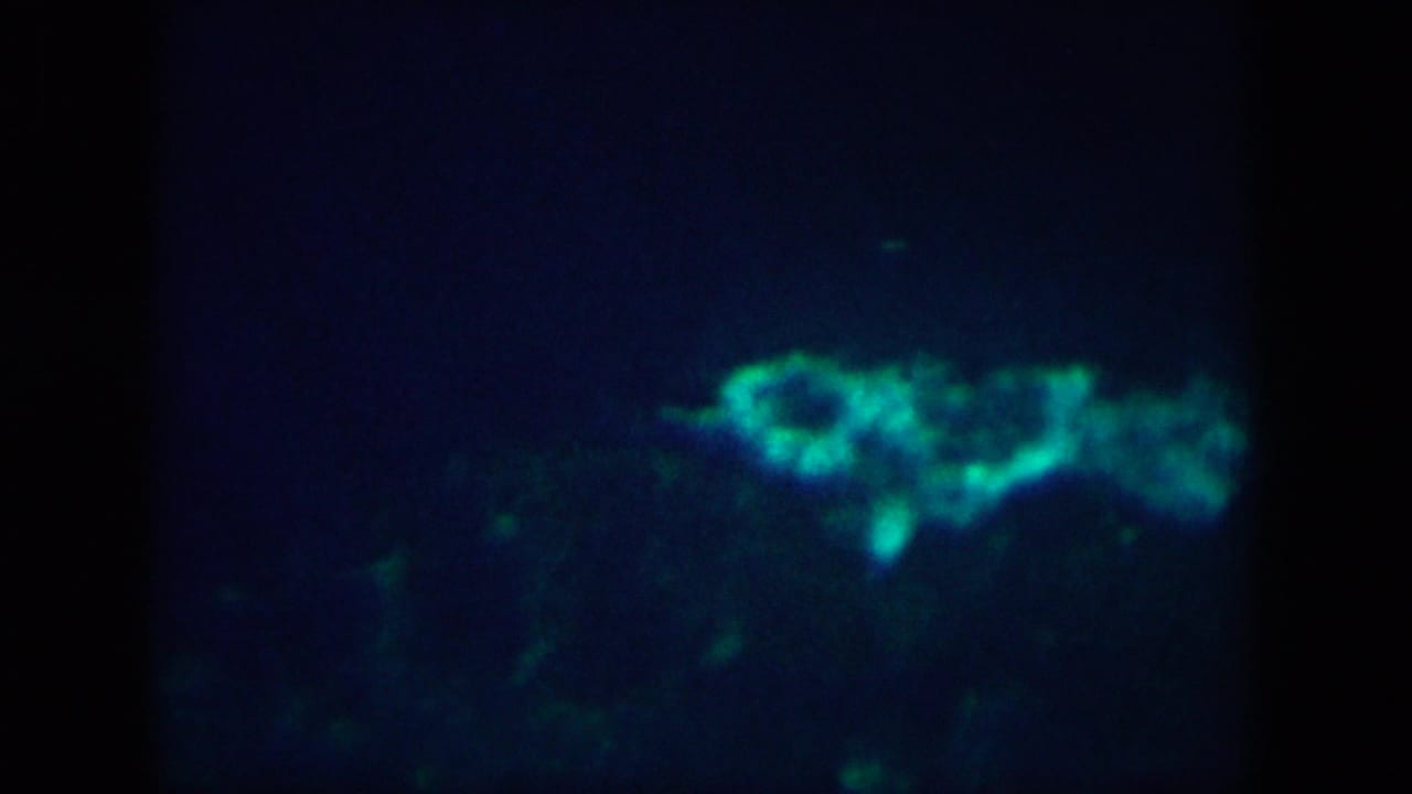 Blue underwater frame with a bright green light band across the upper right.