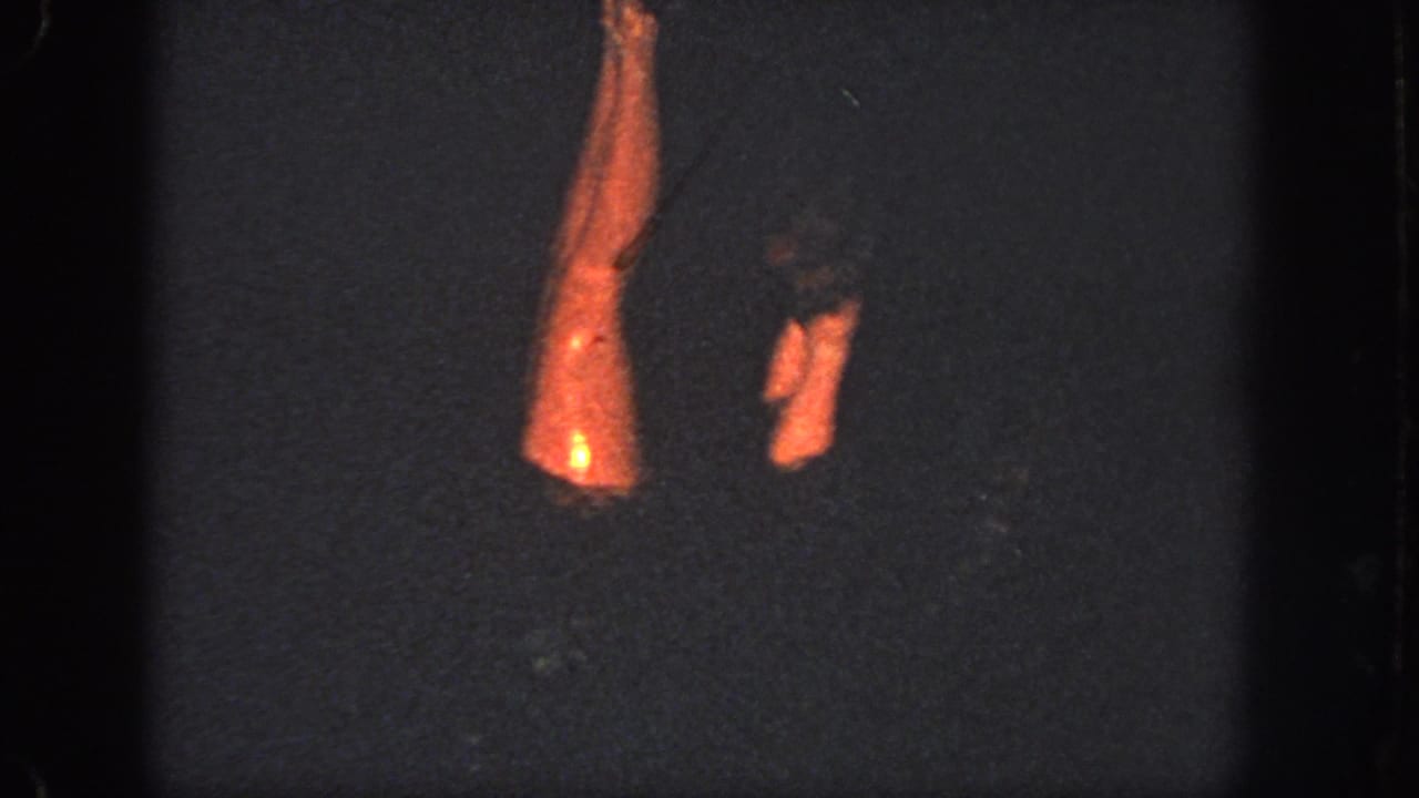 A swimmer's raised leg and another lower leg show above dark water.
