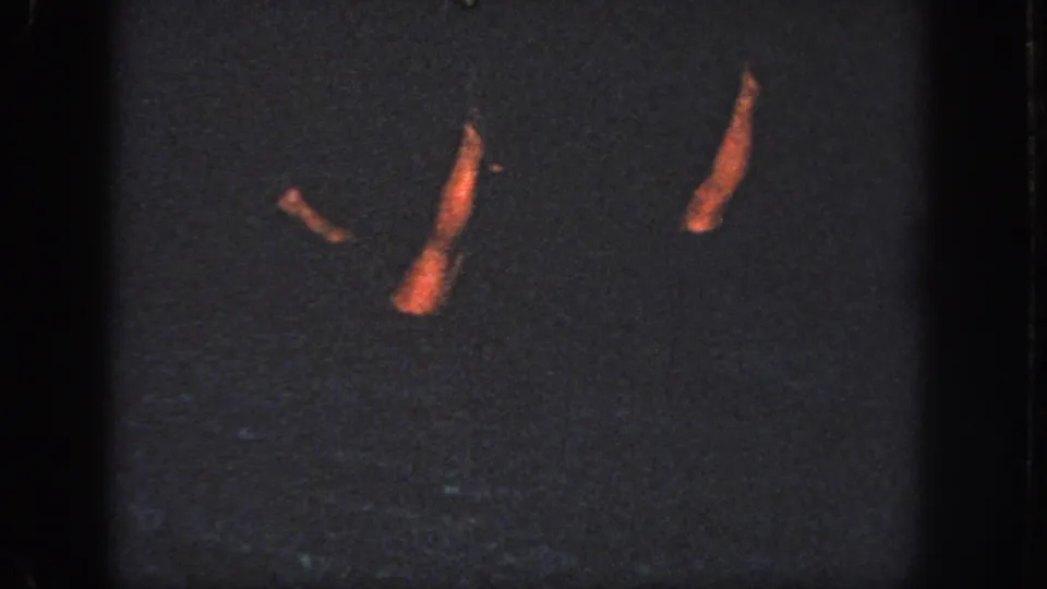 Multiple legs and feet appear above or just below the dark pool surface during the synchronized swimming routine in Atlanta, 1951.