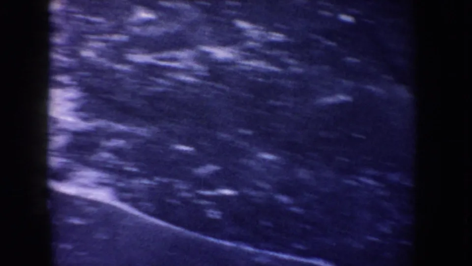 Blue-toned 8mm view of frozen lake ice in Idaho, showing a curved bright line and dense grain.