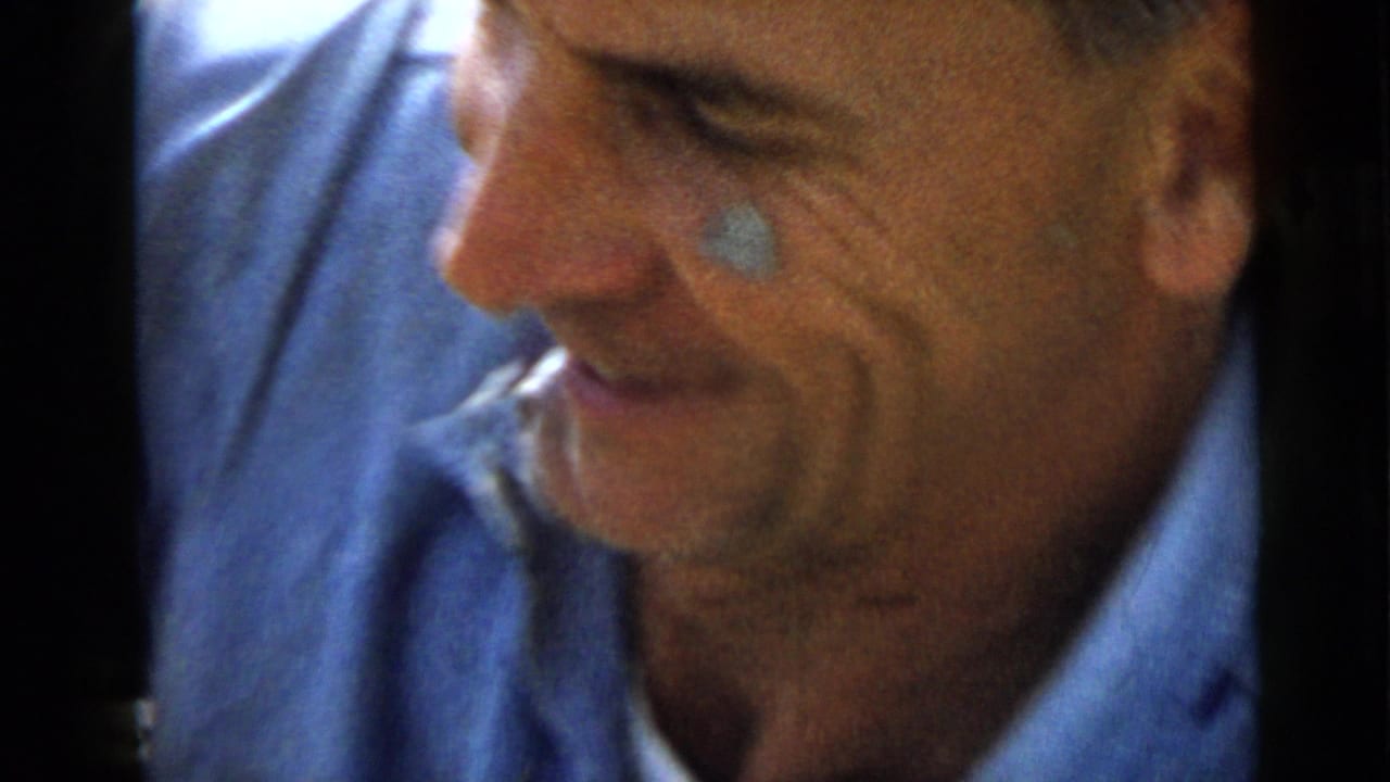 Smiling man in a blue shirt seen close-up with a small pale mark on his cheek.