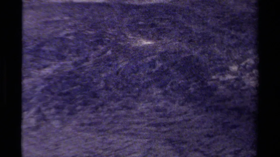 1979 8mm home-movie frame of indistinct alpine ground or slope in British Columbia, with coarse grain, soft focus, and a small bright snow patch.