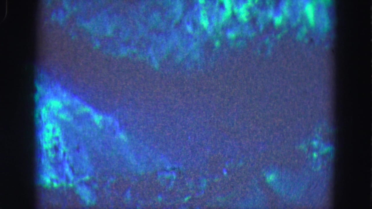 Diffuse turquoise and blue forms spread across a dark, grainy frame.
