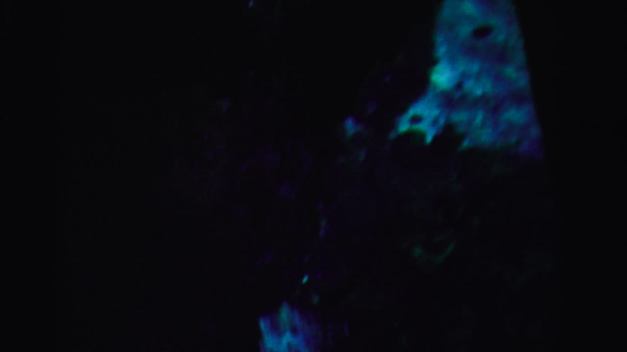 Dark frame with blue-green patches and indistinct foliage-like shapes.