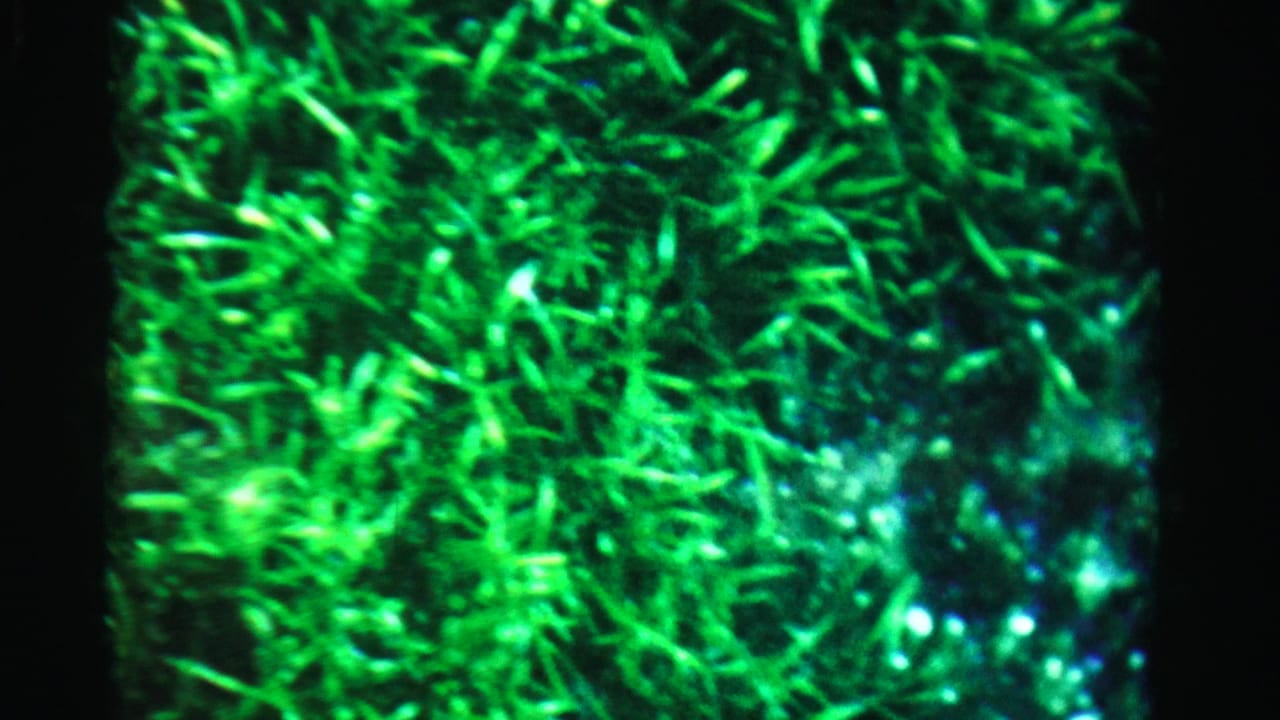 Dense bright green leaves or grass-like plants appear against a dark background.