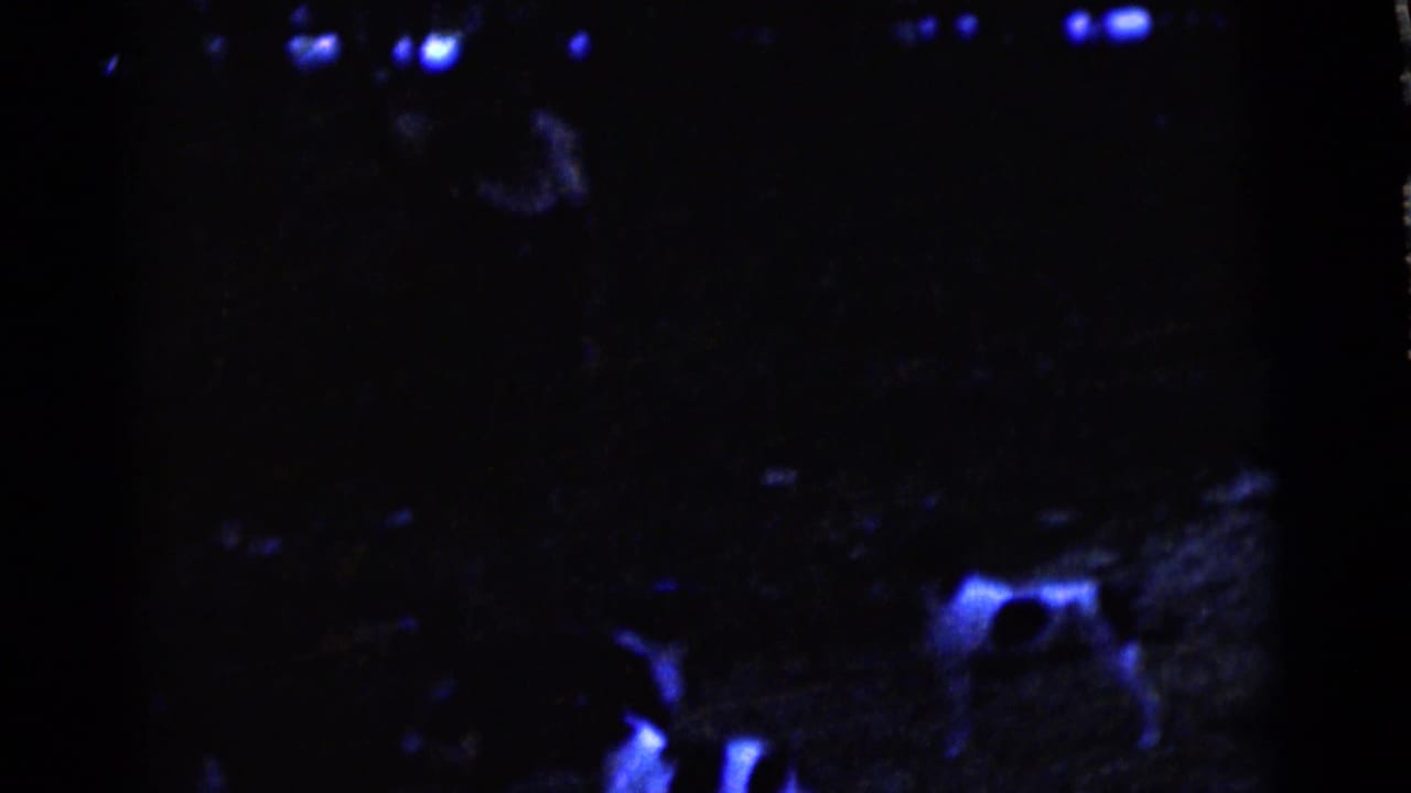 Dark blue-tinted yard scene with a dog partly visible near the center.