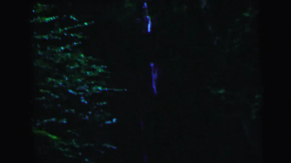 Underexposed 8mm frame showing dense summer foliage with partial shadowed figures; detail is severely limited by exposure conditions, c. 1964.