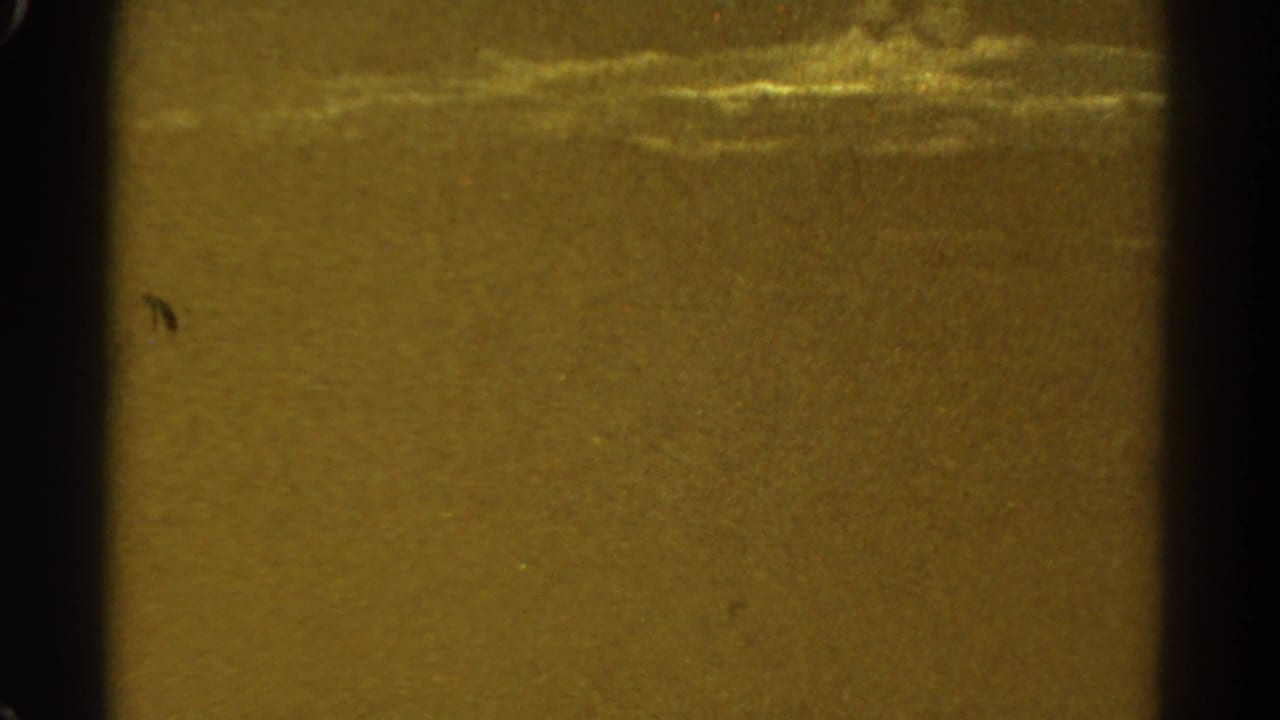 Grainy brown field with a dark central edge and faint light bands near the upper right.