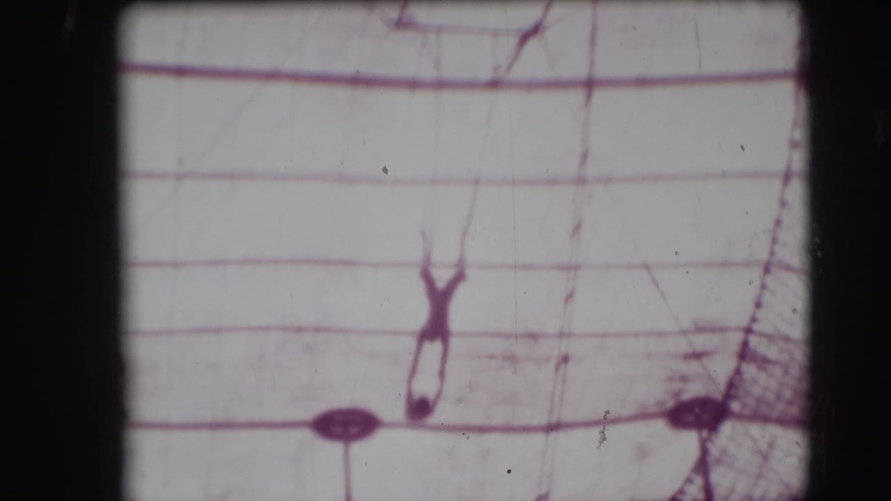 Trapeze performer silhouetted high against circus tent canvas and rigging.