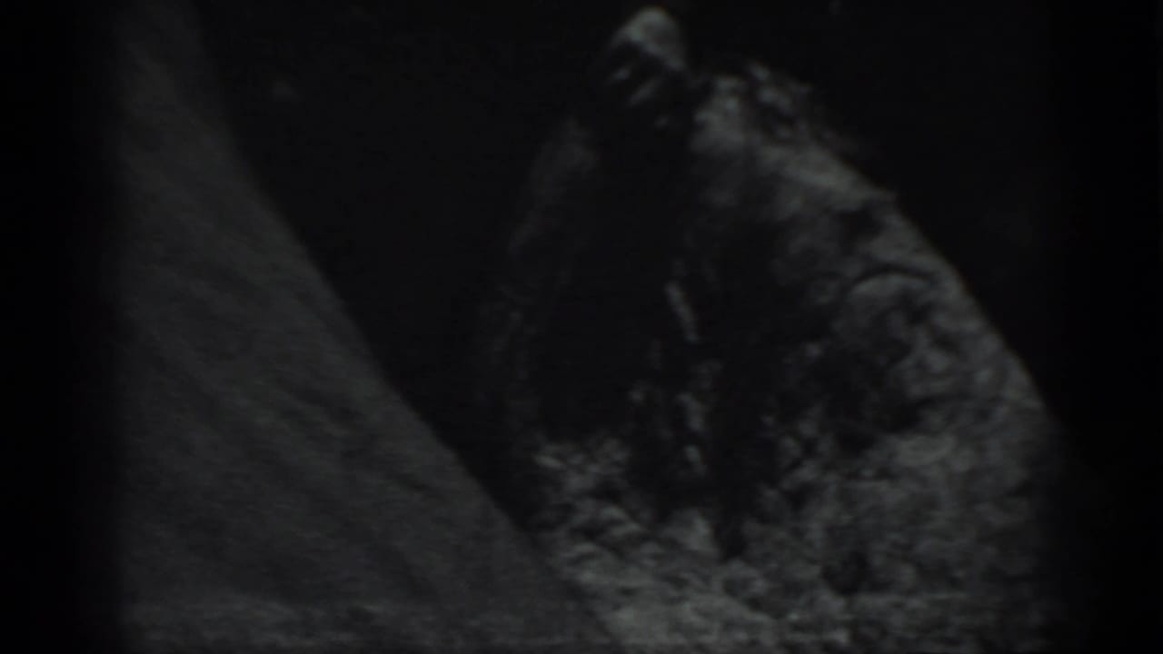 Dark grainy close-up of a rough textured surface beside a pale sloped area.