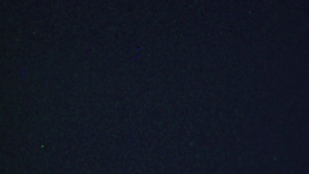 Mostly dark, grainy frame with faint film texture and little discernible subject detail.