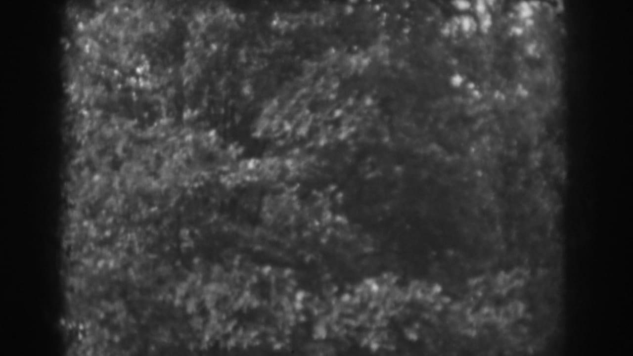 Tree canopy and foliage seen through grainy black-and-white film.