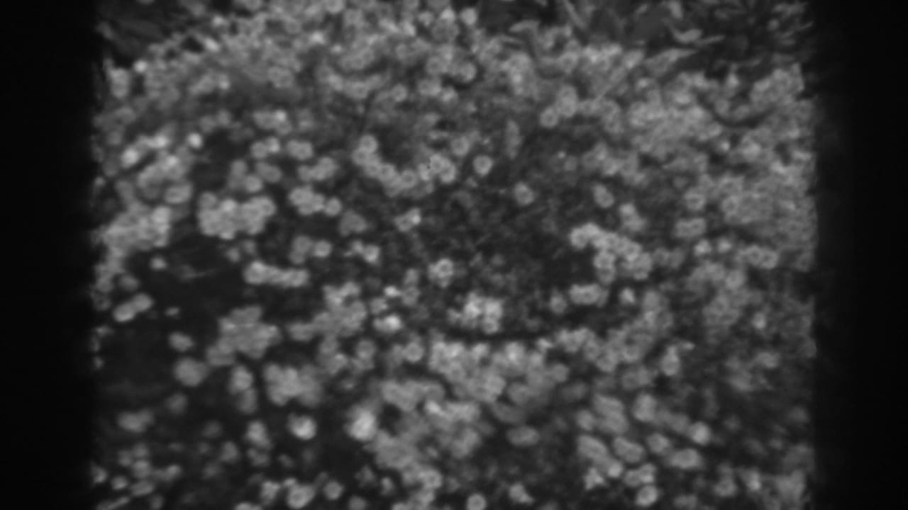 Soft black-and-white close-up of dense fuzzy carpet fibers.