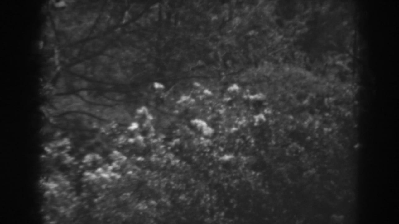 Black-and-white treetops and branches seen through dark 8mm frame edges.