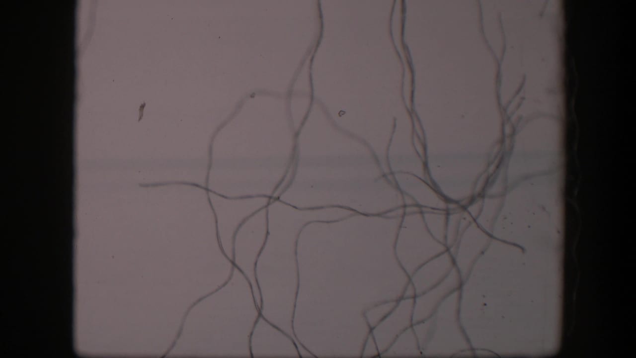 Dark tangled strands crossing a pale field with black film borders.
