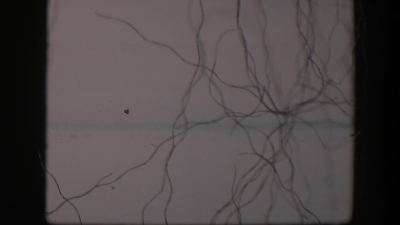 Fine branching filaments cross a pale microscope field with dark film borders.