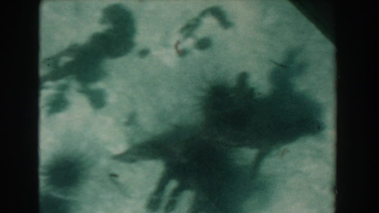 Underwater sandy bottom with several dark sea urchins and blurred plant matter.