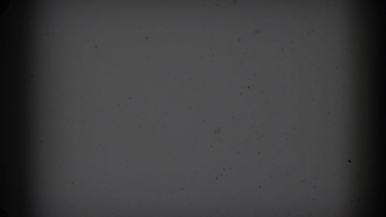 Mostly blank gray 8mm frame with vertical dark band, dust, and scratches.