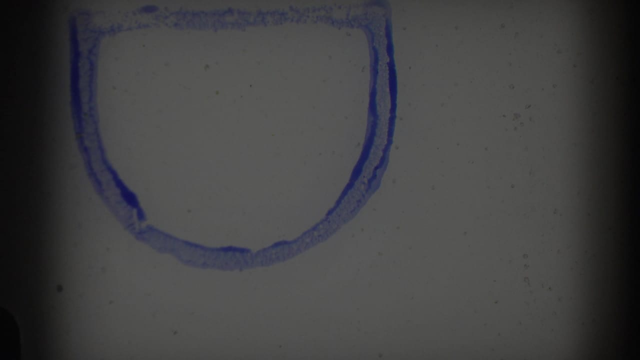 Pale film frame with a blue outlined mark near the top edge.